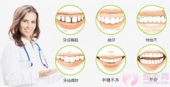 牙齿矫正方法主要有哪些