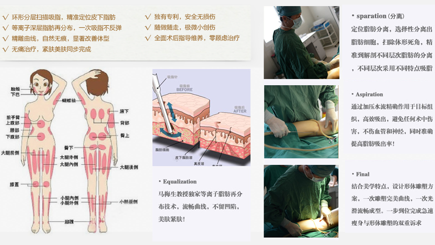 北京清木马梅生吸脂减肥技术特点